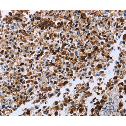 Immunohistochemistry - CXCR3 Antibody from Signalway Antibody (36881) - Antibodies.com