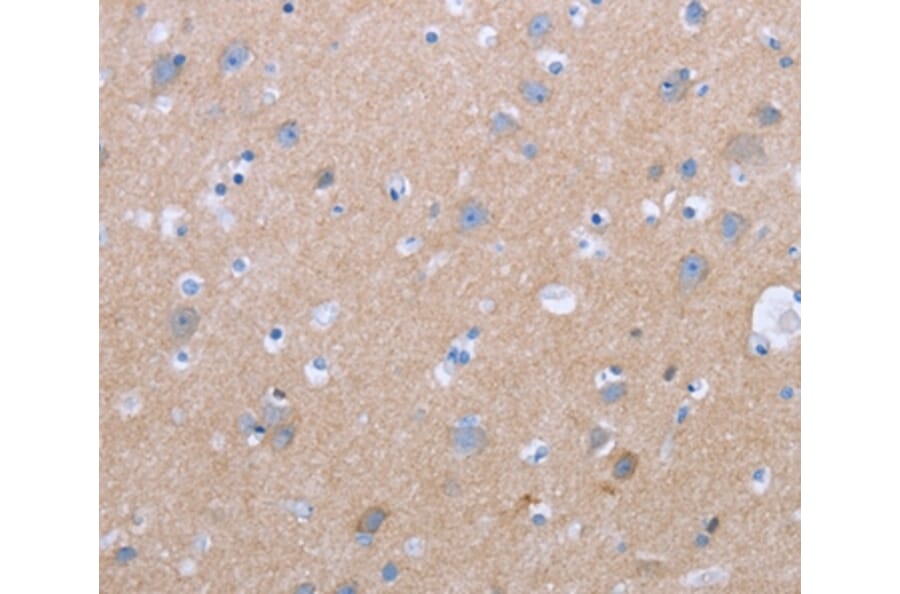 Immunohistochemistry - CXCR3 Antibody from Signalway Antibody (36881) - Antibodies.com