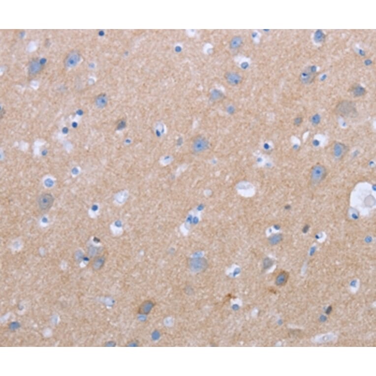 Immunohistochemistry - CXCR3 Antibody from Signalway Antibody (36881) - Antibodies.com