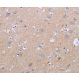 Immunohistochemistry - CXCR3 Antibody from Signalway Antibody (36881) - Antibodies.com