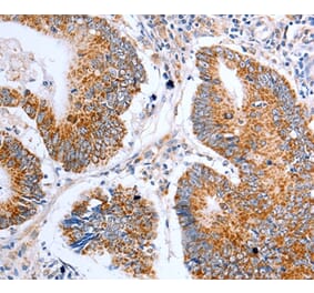 Immunohistochemistry - CLDN10 Antibody from Signalway Antibody (36892) - Antibodies.com