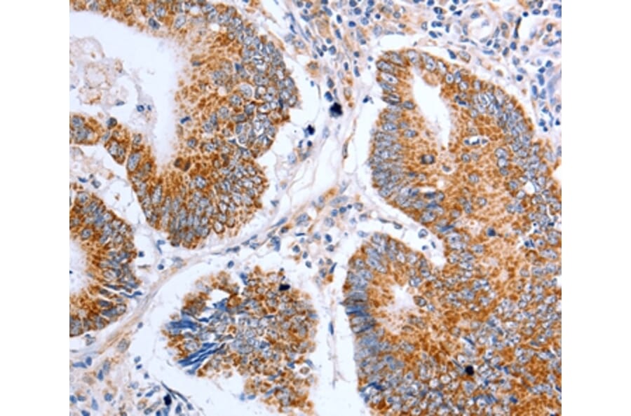 Immunohistochemistry - CLDN10 Antibody from Signalway Antibody (36892) - Antibodies.com