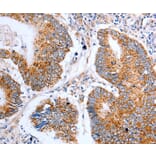 Immunohistochemistry - CLDN10 Antibody from Signalway Antibody (36892) - Antibodies.com
