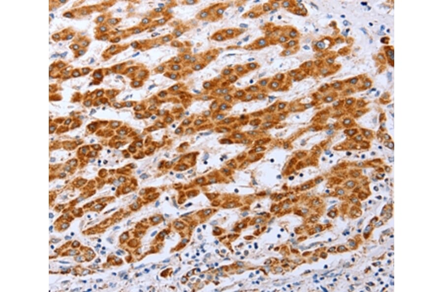 Immunohistochemistry - CLDN10 Antibody from Signalway Antibody (36892) - Antibodies.com