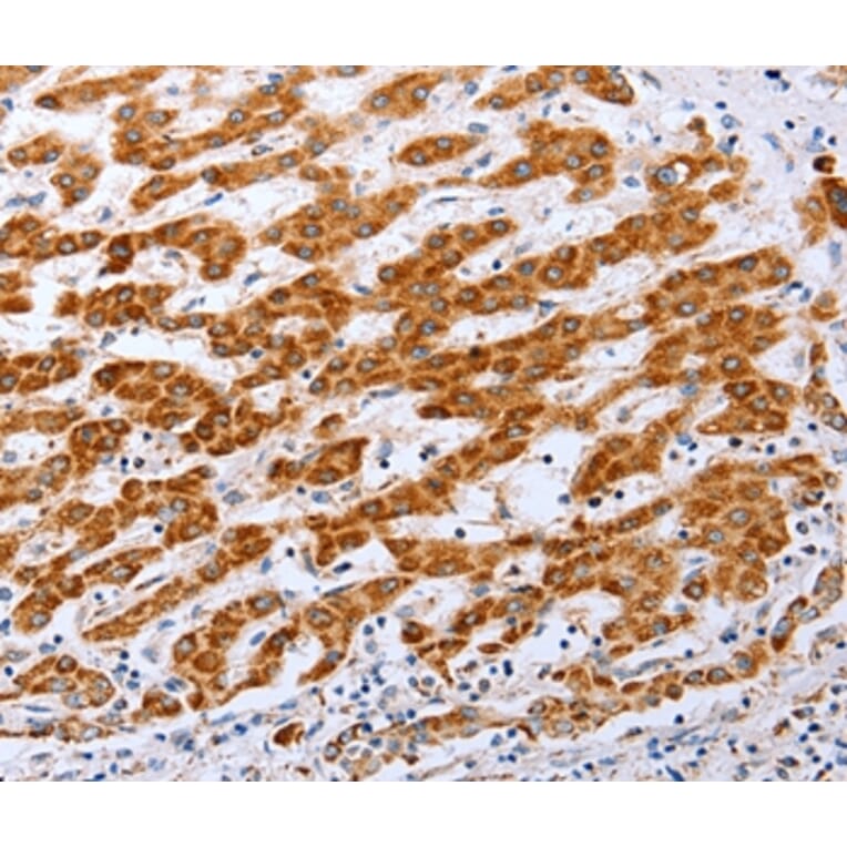 Immunohistochemistry - CLDN10 Antibody from Signalway Antibody (36892) - Antibodies.com