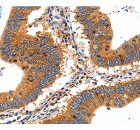 Immunohistochemistry - SLC2A2 Antibody from Signalway Antibody (36902) - Antibodies.com