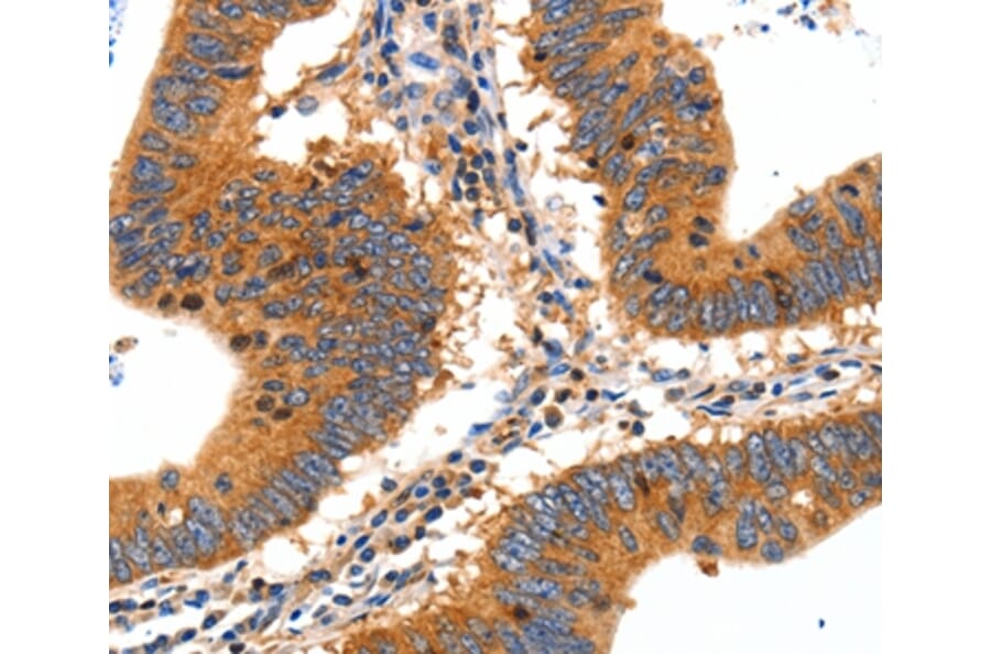 Immunohistochemistry - SLC2A2 Antibody from Signalway Antibody (36902) - Antibodies.com