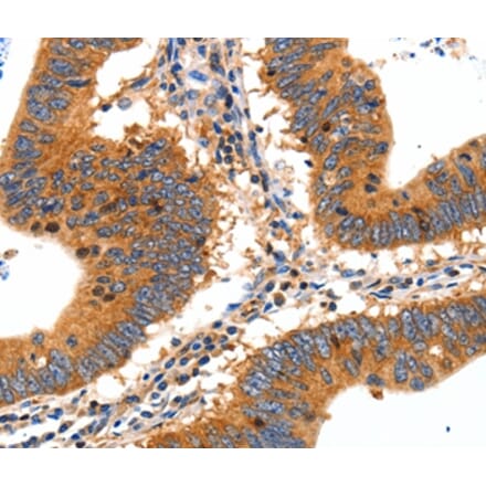 Immunohistochemistry - SLC2A2 Antibody from Signalway Antibody (36902) - Antibodies.com