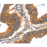 Immunohistochemistry - SLC2A2 Antibody from Signalway Antibody (36902) - Antibodies.com