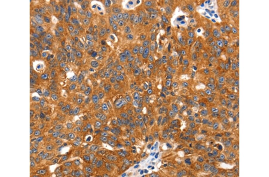 Immunohistochemistry - SLC2A2 Antibody from Signalway Antibody (36902) - Antibodies.com