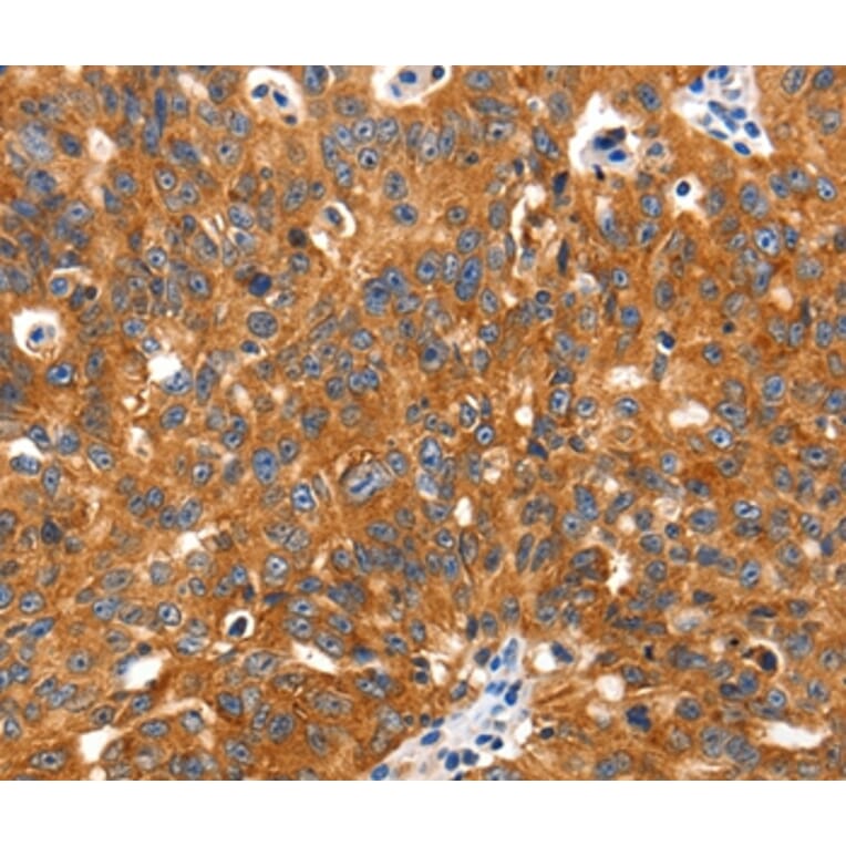 Immunohistochemistry - SLC2A2 Antibody from Signalway Antibody (36902) - Antibodies.com