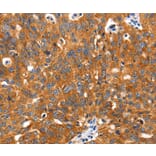 Immunohistochemistry - SLC2A2 Antibody from Signalway Antibody (36902) - Antibodies.com