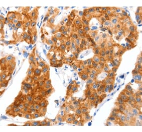 Immunohistochemistry - SLC2A4 Antibody from Signalway Antibody (36903) - Antibodies.com