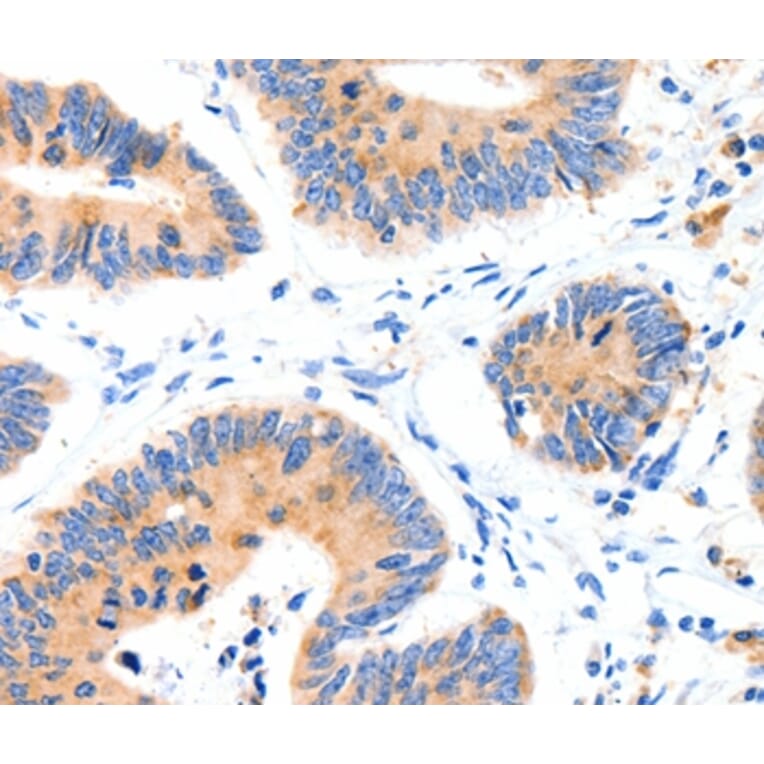 Immunohistochemistry - SLC2A4 Antibody from Signalway Antibody (36903) - Antibodies.com