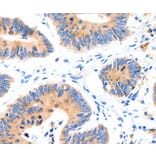 Immunohistochemistry - SLC2A4 Antibody from Signalway Antibody (36903) - Antibodies.com