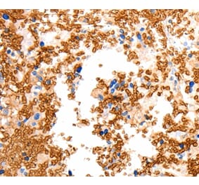 Immunohistochemistry - SLC2A5 Antibody from Signalway Antibody (36904) - Antibodies.com