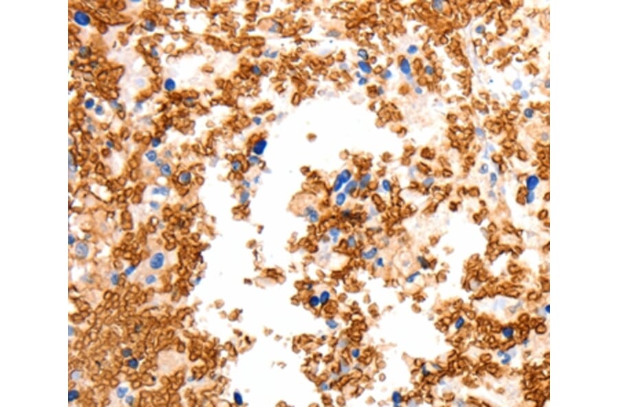 Immunohistochemistry - SLC2A5 Antibody from Signalway Antibody (36904) - Antibodies.com