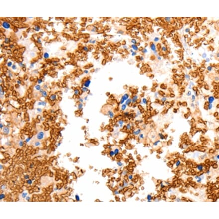 Immunohistochemistry - SLC2A5 Antibody from Signalway Antibody (36904) - Antibodies.com