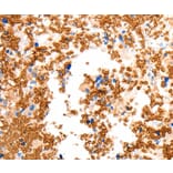 Immunohistochemistry - SLC2A5 Antibody from Signalway Antibody (36904) - Antibodies.com