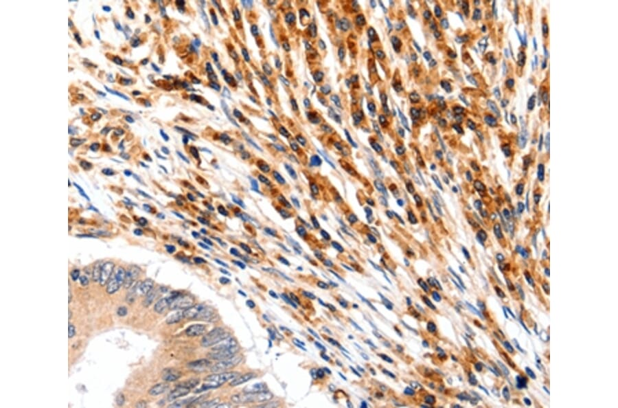 Immunohistochemistry - SLC2A5 Antibody from Signalway Antibody (36904) - Antibodies.com