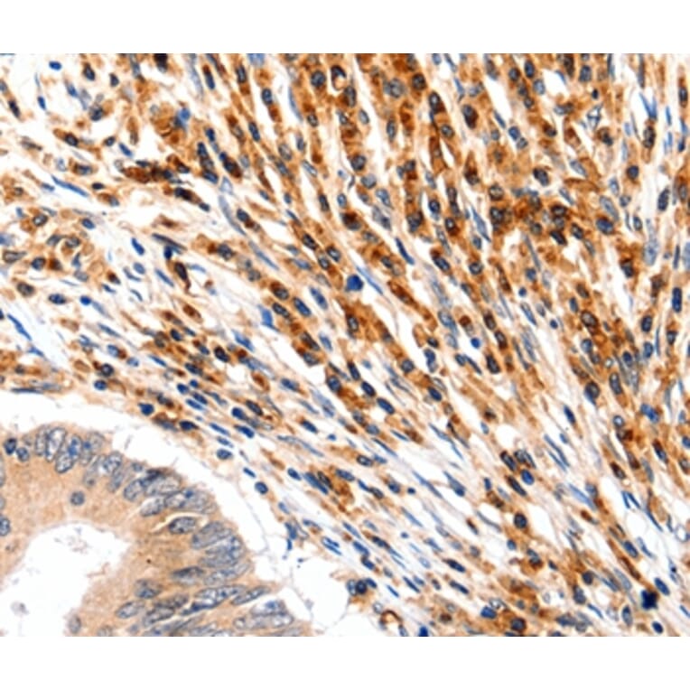 Immunohistochemistry - SLC2A5 Antibody from Signalway Antibody (36904) - Antibodies.com
