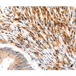 Immunohistochemistry - SLC2A5 Antibody from Signalway Antibody (36904) - Antibodies.com