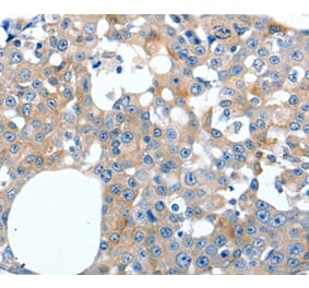 Immunohistochemistry - LILRB3 Antibody from Signalway Antibody (36936) - Antibodies.com