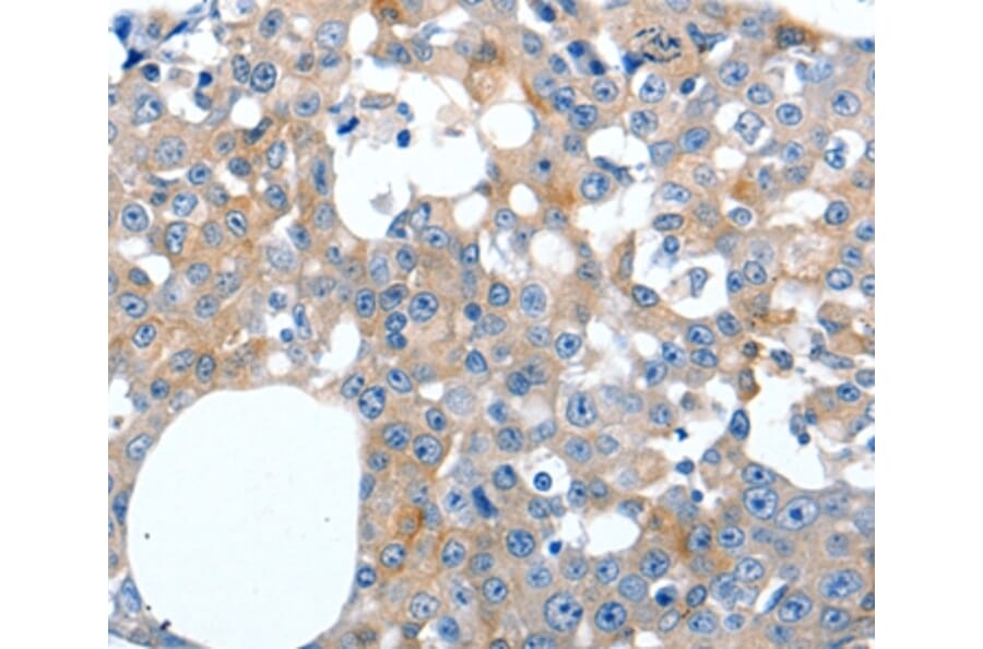 Immunohistochemistry - LILRB3 Antibody from Signalway Antibody (36936) - Antibodies.com