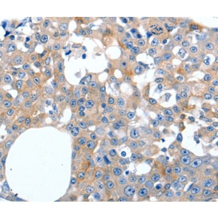 Immunohistochemistry - LILRB3 Antibody from Signalway Antibody (36936) - Antibodies.com