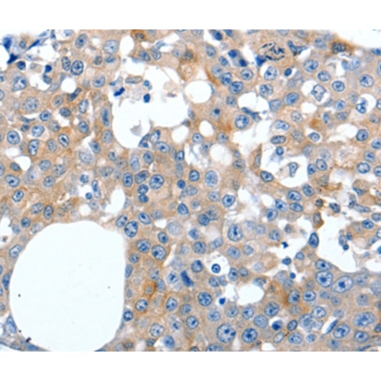 Immunohistochemistry - LILRB3 Antibody from Signalway Antibody (36936) - Antibodies.com