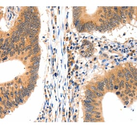 Immunohistochemistry - LRPPRC Antibody from Signalway Antibody (36960) - Antibodies.com