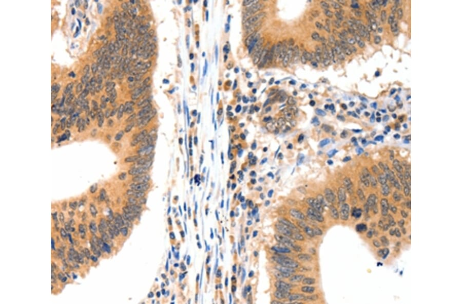 Immunohistochemistry - LRPPRC Antibody from Signalway Antibody (36960) - Antibodies.com