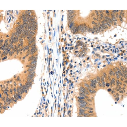 Immunohistochemistry - LRPPRC Antibody from Signalway Antibody (36960) - Antibodies.com