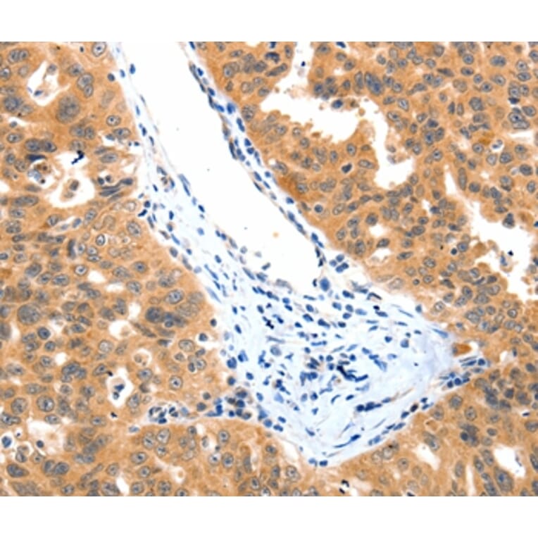 Immunohistochemistry - LRPPRC Antibody from Signalway Antibody (36960) - Antibodies.com