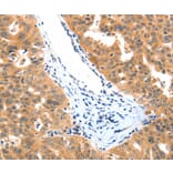 Immunohistochemistry - LRPPRC Antibody from Signalway Antibody (36960) - Antibodies.com