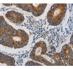 Immunohistochemistry - MAP3K5 Antibody from Signalway Antibody (36967) - Antibodies.com
