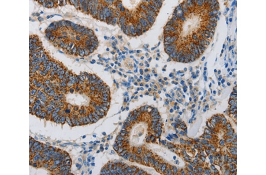 Immunohistochemistry - MAP3K5 Antibody from Signalway Antibody (36967) - Antibodies.com