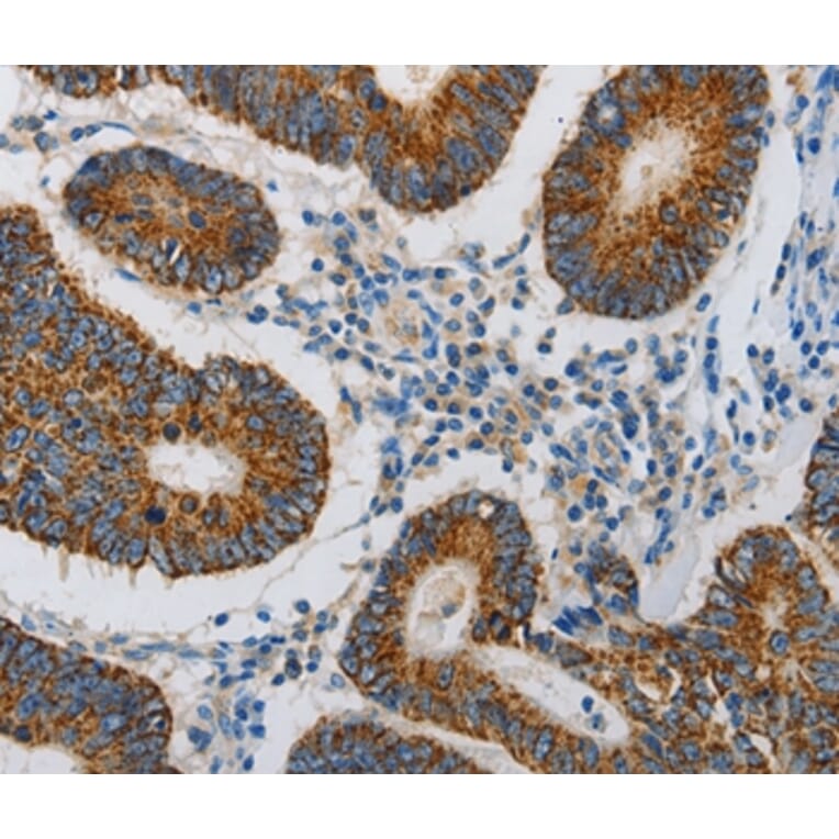Immunohistochemistry - MAP3K5 Antibody from Signalway Antibody (36967) - Antibodies.com