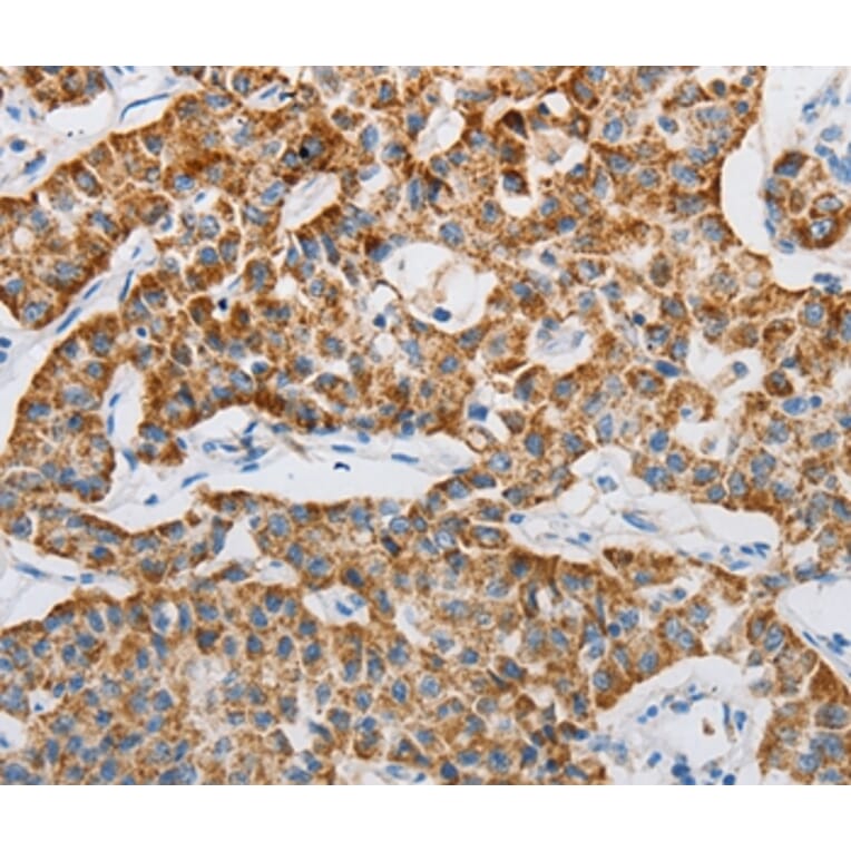 Immunohistochemistry - MAP3K5 Antibody from Signalway Antibody (36967) - Antibodies.com