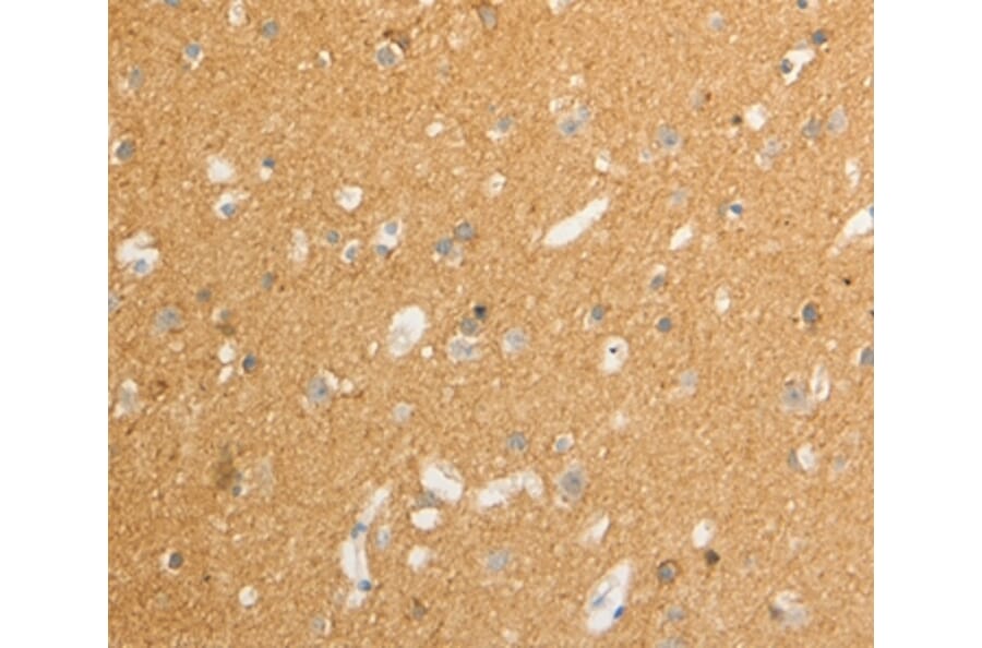 Immunohistochemistry - ATP1A1 Antibody from Signalway Antibody (36978) - Antibodies.com