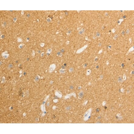 Immunohistochemistry - ATP1A1 Antibody from Signalway Antibody (36978) - Antibodies.com