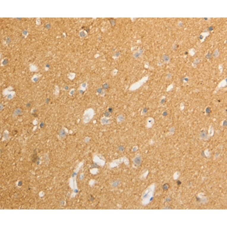 Immunohistochemistry - ATP1A1 Antibody from Signalway Antibody (36978) - Antibodies.com