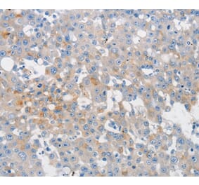 Immunohistochemistry - MUC5AC Antibody from Signalway Antibody (36988) - Antibodies.com