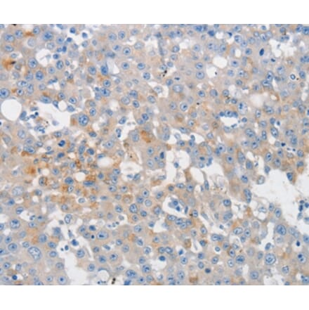 Immunohistochemistry - MUC5AC Antibody from Signalway Antibody (36988) - Antibodies.com