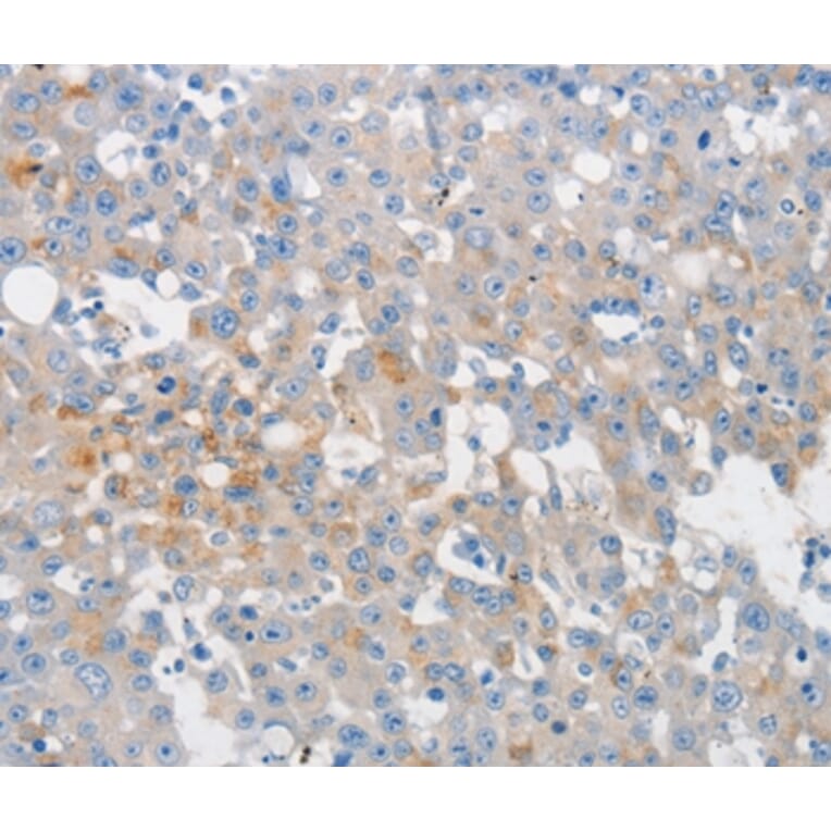 Immunohistochemistry - MUC5AC Antibody from Signalway Antibody (36988) - Antibodies.com