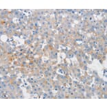 Immunohistochemistry - MUC5AC Antibody from Signalway Antibody (36988) - Antibodies.com