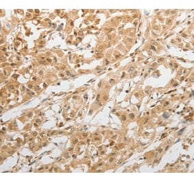 Immunohistochemistry - GRIN2C Antibody from Signalway Antibody (37003) - Antibodies.com