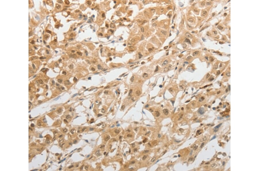 Immunohistochemistry - GRIN2C Antibody from Signalway Antibody (37003) - Antibodies.com