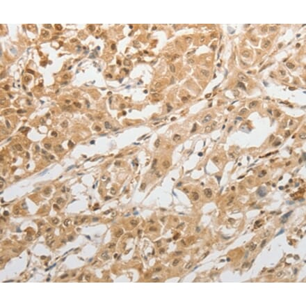 Immunohistochemistry - GRIN2C Antibody from Signalway Antibody (37003) - Antibodies.com