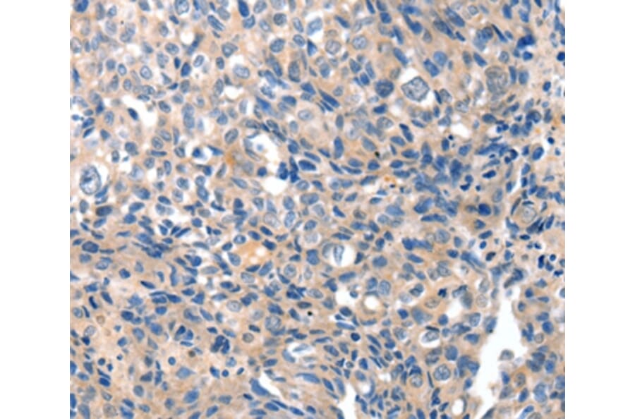 Immunohistochemistry - GRIN2D Antibody from Signalway Antibody (37004) - Antibodies.com